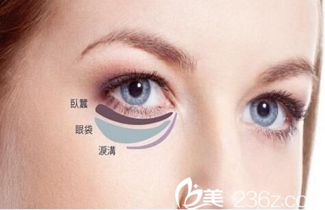 眼袋抽脂價(jià)格影響因素