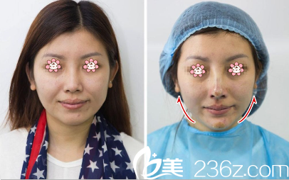 貴州做面部線雕好的醫(yī)生是哪個 貴州做面部線雕好的醫(yī)生是哪個