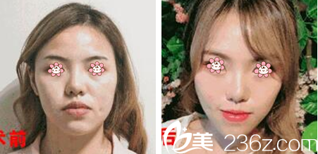 汪國應(yīng)線雕案例 汪國應(yīng)線雕案例