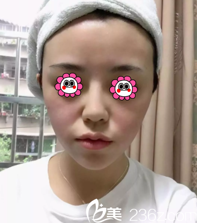 北京華韓熱瑪吉美膚案例 北京華韓熱瑪吉美膚案例