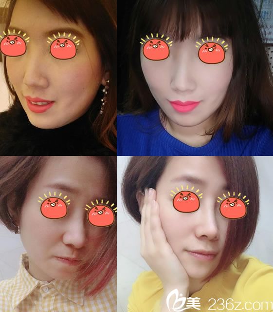 寧波薇琳黃榮案例 寧波薇琳黃榮案例