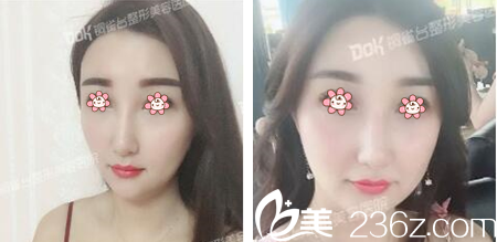 重慶銅雀臺(tái)宋居財(cái)祛痘案例