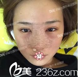 <!--<i data=20240703-sp></i>-->院長(zhǎng)給子墨手術(shù)后第三天 <!--<i data=20240703-sp></i>-->院長(zhǎng)給子墨手術(shù)后第三天