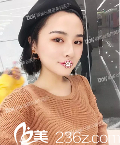 <!--<i data=20240703-sp></i>-->鼻綜合術(shù)后一個(gè)月 <!--<i data=20240703-sp></i>-->鼻綜合術(shù)后一個(gè)月