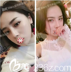 術(shù)后45天 術(shù)后45天