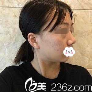 手術(shù)前的我 手術(shù)前的我