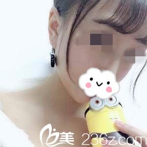 注射好不好？看我在哈爾濱名人醫(yī)療美容醫(yī)院做的不但效果好，價(jià)格也特別公道