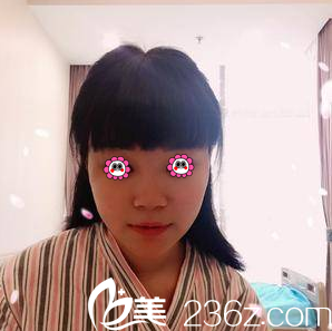 在北京米揚(yáng)麗格做隆鼻前樣子 在北京米揚(yáng)麗格做隆鼻前樣子