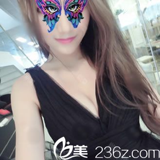 杭州維多利亞做完隆胸30天照片