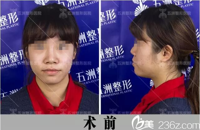 術(shù)前照片 術(shù)前照片