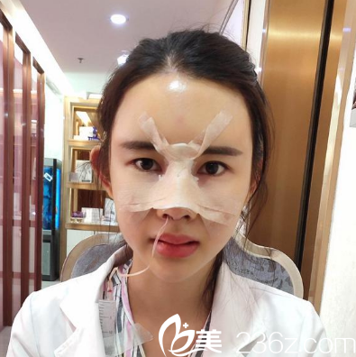 深圳妍熙陳桂飛鼻修復(fù)術(shù)后3天