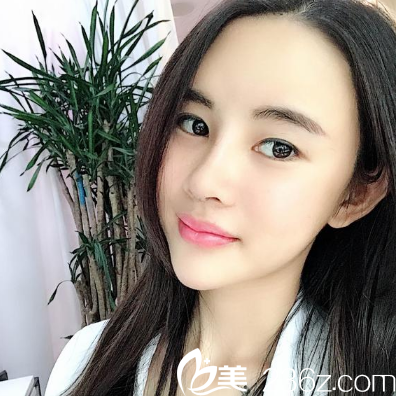 深圳妍熙陳桂飛做的鼻修復(fù)7天效果圖