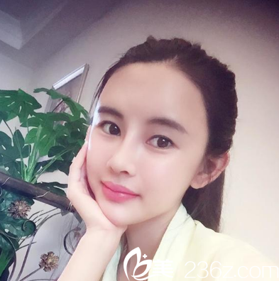 深圳妍熙陳桂飛鼻修復(fù)案例半個(gè)月效果圖