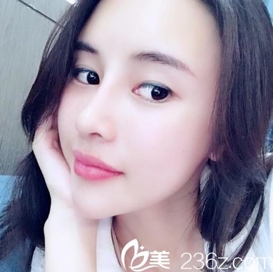 深圳妍熙陳桂飛做的隆鼻失敗修復(fù)案例