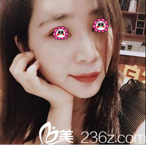 閨蜜說我在北京亞韓做V塑加面部脂肪填充價格公道效果不錯