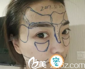 看醫(yī)生給我畫的線哦