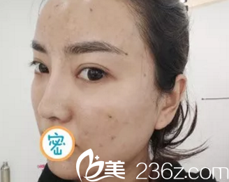 我的臉真的是臟到一種境界