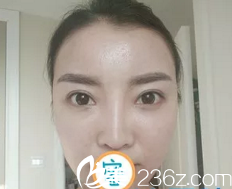 為在煙臺做個自體脂肪填充面部手術(shù)，我快跑完所有醫(yī)院了