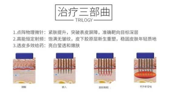 黃金點陣射頻原理