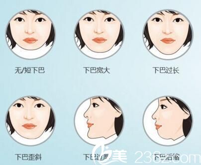 不好看的下巴有很多種