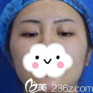 手術(shù)前的我 手術(shù)前的我