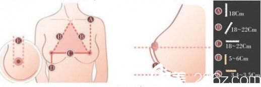 自體脂肪隆胸優(yōu)勢(shì)