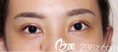 恢復(fù)的特別快 恢復(fù)的特別快