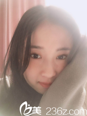 距離我在濰坊華美做全切雙眼皮整形已經(jīng)三個(gè)月了，分享我的恢復(fù)過程