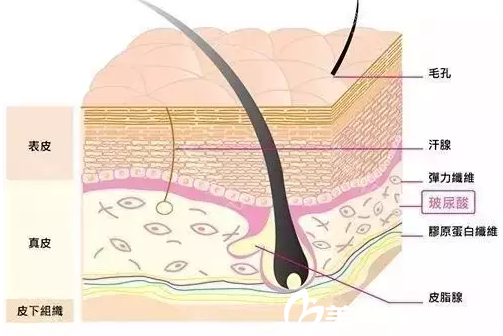 玻尿酸注射在皮膚的位置 玻尿酸注射在皮膚的位置