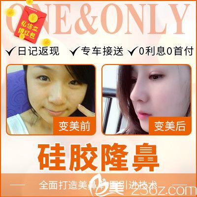 順德壹加壹瑪麗亞整容醫(yī)院肖鵬做的隆鼻<span style= 順德壹加壹瑪麗亞整容醫(yī)院肖鵬做的隆鼻<span style=