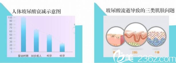 打玻尿酸面部僵硬應(yīng)該怎么辦？