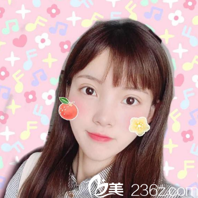 佛山華美整形醫(yī)院雙眼皮<span style= 佛山華美整形醫(yī)院雙眼皮<span style=