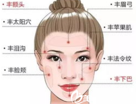 自體脂肪可填充部位展示圖