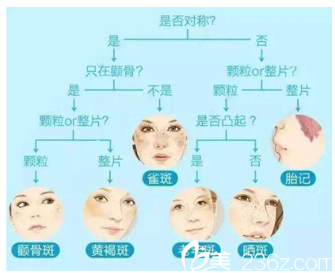 斑點(diǎn)種類不通，價(jià)格不同