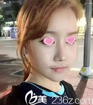 術(shù)后28天 術(shù)后28天