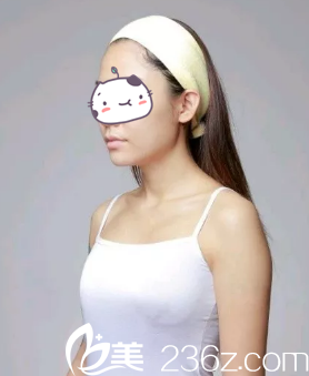 術(shù)前胸部平坦 術(shù)前胸部平坦