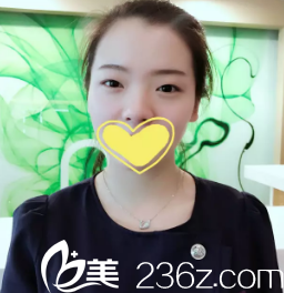 術(shù)前單眼皮 術(shù)前單眼皮