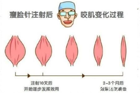 打瘦臉不良影響：使用不當(dāng)