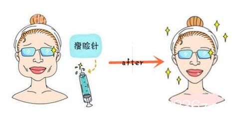 打瘦臉不良影響：瘦臉品質(zhì)有關(guān)