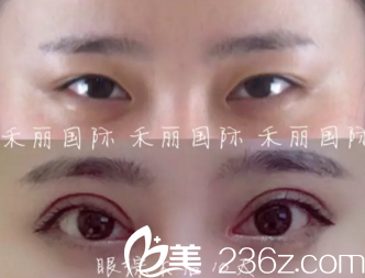 李超“七度媚眼術(shù)”真人案例