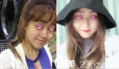 北京<!--<i data=20240703-sp></i>--><!--<i data=20240703-sp></i>-->面部提升