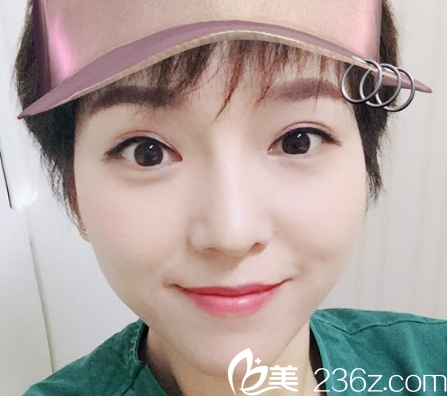 這是我恢復30天后的樣子