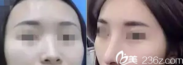 芳藝整形楊偉主任<span style= 芳藝整形楊偉主任<span style=