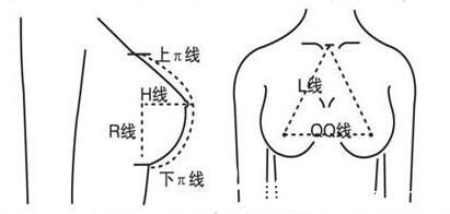什么是假體隆胸？