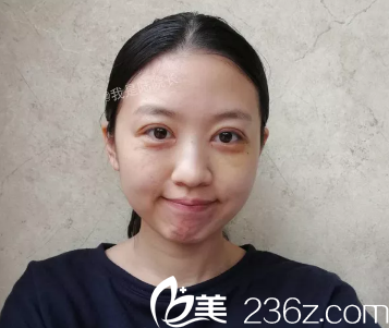 真的不能怪我這么快想到修復(fù)這個問題