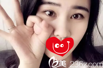 大連整形哪家好？看我花8000元找大連新華美天張井忠割雙眼皮2個月的恢復效果