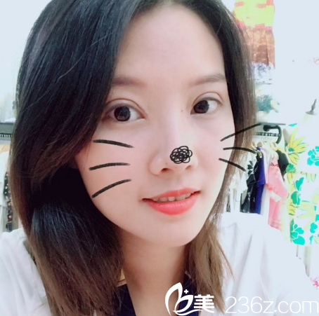 廣州天姿雙眼皮 廣州天姿雙眼皮