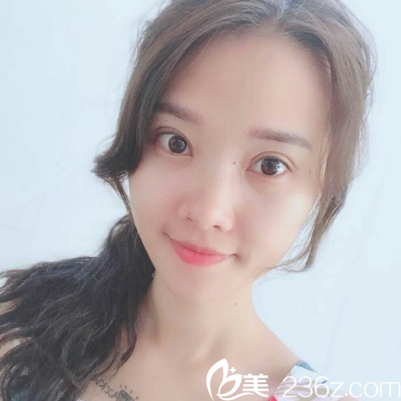 看到閨蜜找廣州天姿整形醫(yī)院院長做的雙眼皮后我也心動了