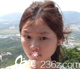 術(shù)前的我 術(shù)前的我