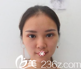 術(shù)后一周 術(shù)后一周